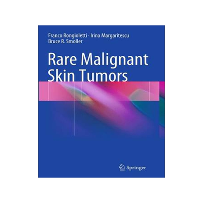 预订 Rare Malignant Skin Tumors