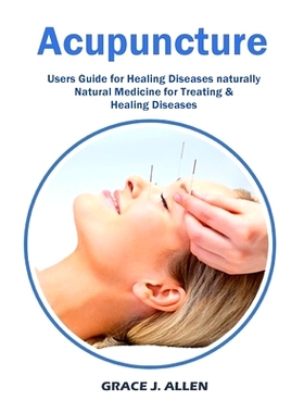 预订 Acupuncture: Users Guide for Healing Diseases naturally Natural Medicine for Treating & Healing Diseases