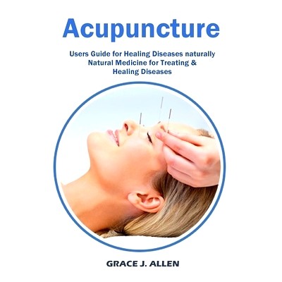 预订 Acupuncture: Users Guide for Healing Diseases naturally Natural Medicine for Treating & Healing Diseases