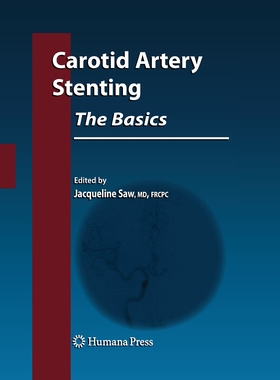 【预订】Carotid Artery Stenting: The Basics