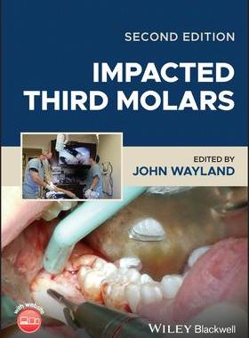 [预订]Impacted Third Molars 9781119930303
