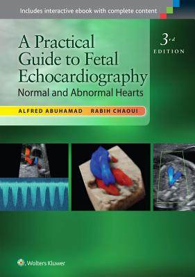 【预订】A Practical Guide to Fetal Echocardiography