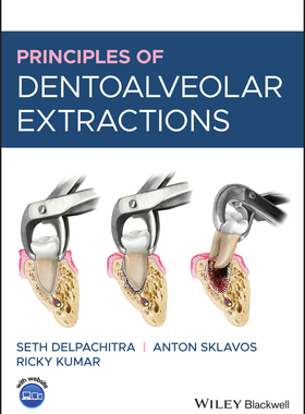 【预订】Principles Of Dentoalveolar Extractions