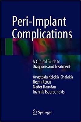 【预售】Peri-Implant Complications