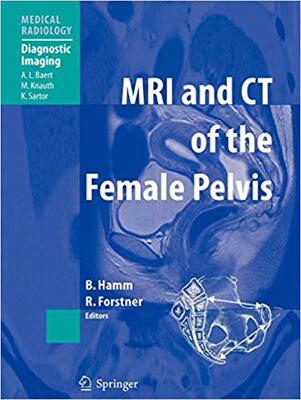 【预订】MRI and CT of the Female Pelvis