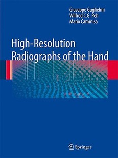 the Hand Radiographs High Resolution 预订