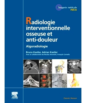 预订 Radiologie interventionnelle osseuse et anti-douleur 介入骨与疼痛放射学: 9782294766312
