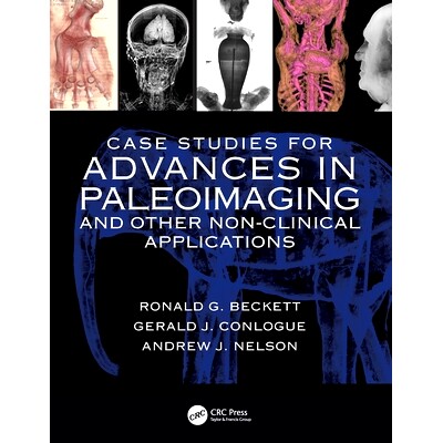 预订 Case Studies for Advances in Paleoimaging and Other Non-Clinical Applications 古成像与其他非临床应用进展的案例研究: