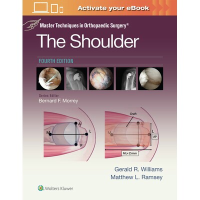 The Shoulder: Print + eBook with Multime