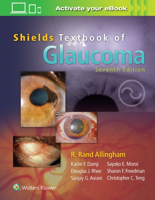 【预订】Shields Textbook of Glaucoma