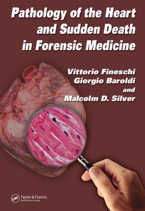 【预订】Pathology of the Heart and Sudden Death in Forensic Medicine
