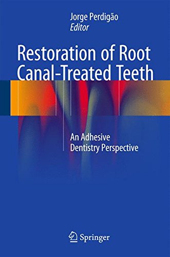 【预订】Restoration of Root Canal-Treated Teeth