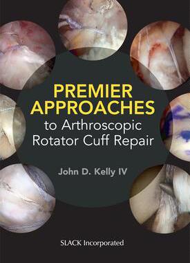 [预订]Premier Approaches to Arthroscopic Rotator Cuff Repair 9781630915629