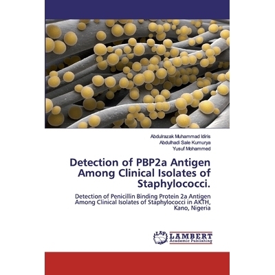 预订 Detection of PBP2a Antigen Among Clinical Isolates of Staphylococci.: Detection of Penicillin Binding Protein 2a An