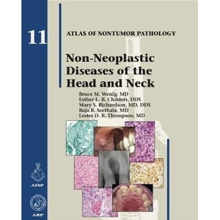 头颈部非发育性疾病 9781933477374 Diseases Head and the Neoplastic 丛书 预订 Neck Non