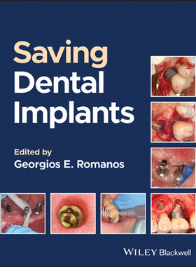 预订 Saving Dental Implants