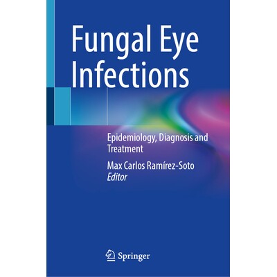 预订 Fungal Eye Infections Epidemiology, Diagnosis and Treatment 真菌性眼部感染：流行病学、诊断与治疗 9783032199225