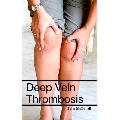 预订 Deep Vein Thrombosis 深静脉血栓形成: 9781632421067