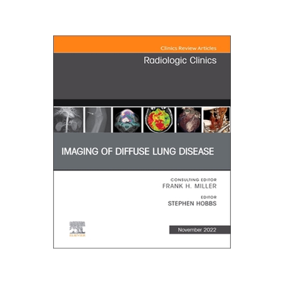 [预订]Imaging of Diffuse Lung Disease, an Issue of Radiologic Clinics of North America
