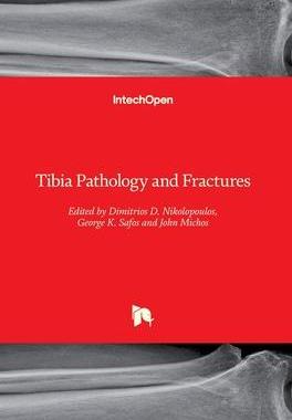 [预订]Tibia Pathology and Fractures 9781839624063