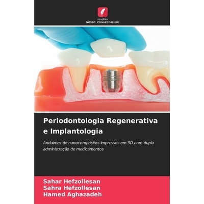预订 Periodontologia Regenerativa e Implantologia: Andaimes de nanocompósitos impressos em 3D com dupla administração