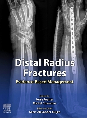 【预订】Distal Radius Fractures: Evidence-Based Management