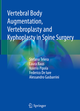 预订 Vertebral Body Augmentation, Vertebroplasty and Kyphoplasty in Spine Surgery
