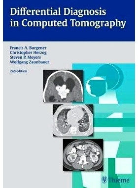 预订 Differential Diagnosis in Computed Tomography 计算机断层扫描的鉴别诊断: 9783131025425