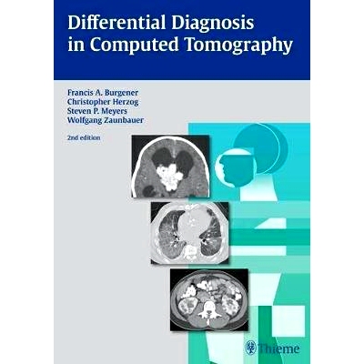 预订 Differential Diagnosis in Computed Tomography 计算机断层扫描的鉴别诊断: 9783131025425