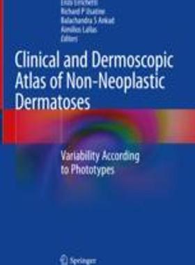 [预订]Clinical and Dermoscopic Atlas of Non-Neoplastic Dermatoses: Variability According to Phototypes 9783031196874