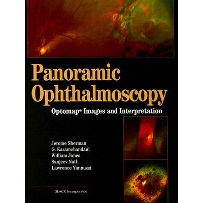 预订 Panoramic Ophthalmoscopy Optomap Images and Interpretation 全景检眼镜检查：Optomap 图像和解释 9781556427800
