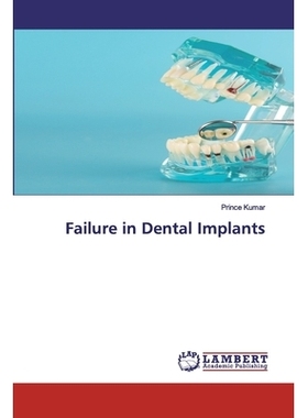 预订 Failure in Dental Implants 种植牙失败: 9786202526593