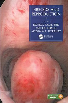 【预订】Fibroids and Reproduction