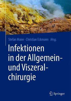 预订 Infektionen in der Allgemein- und Viszeralchirurgie - 实物图