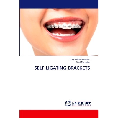 预订 Self Ligating Brackets: 9786207487745
