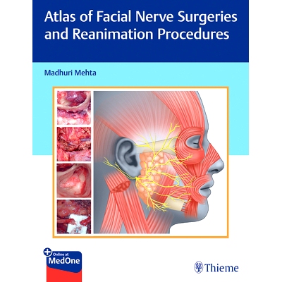 预订 Atlas of Facial Nerve Surgeries and Reanimation Procedures 面神经手术和恢复程序图集: 9789392819131