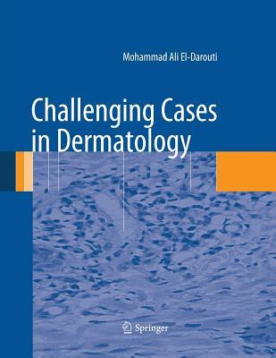 【预订】Challenging Cases in Dermatology