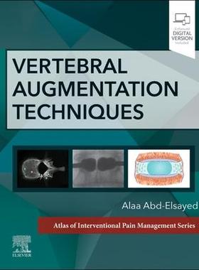 [预订]Vertebral Augmentation Techniques 9780323882262