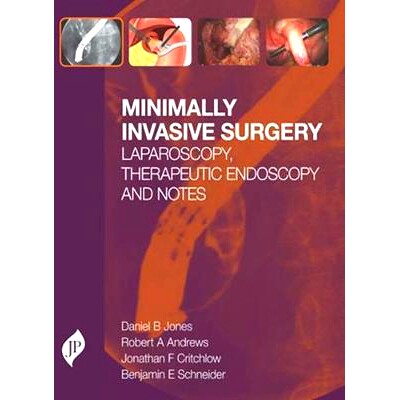 预订 Minimally Invasive Surgery: Laparoscopy, Therapeutic Endoscopy and NOTES: 9781907816192