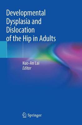 预订 Developmental Dysplasia and Dislocation of the Hip in Adults
