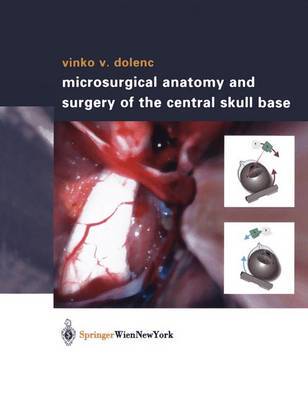 【预订】Microsurgical Anatomy and Surgery of the Central Skull Base