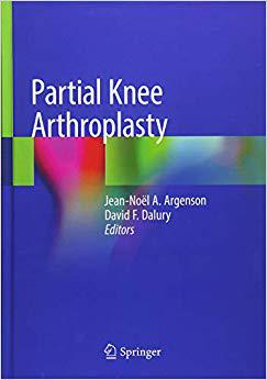 【预售】Partial Knee Arthroplasty