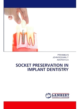 预订 Socket Preservation in Implant Dentistry 种植牙的牙槽保存: 9786208064570
