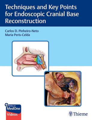 [预订]Techniques and Key Points for Endoscopic Cranial Base Reconstruction 9781684202324 书籍/杂志/报纸 原版其它 原图主图