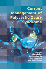 【预订】Current Management of Polycystic Ovary Syndrome