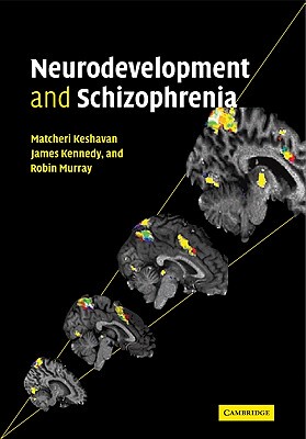 【预订】Neurodevelopment and Schizophrenia
