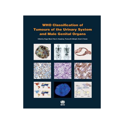 现货  Who Classification of Tumours of the...