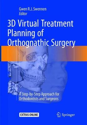 【预订】3D Virtual Treatment Planning of Orthognathic Surgery