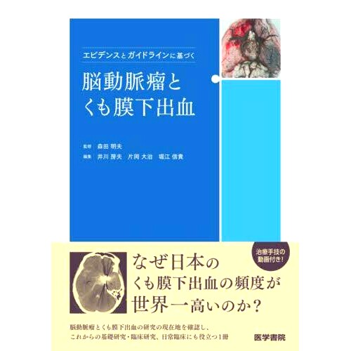 预订 エビデンスとガイドラインに基づく脳動脈瘤とくも膜下出血 基于证据和指南的脑动脉瘤和蛛网膜下腔出血: 9784260050982
