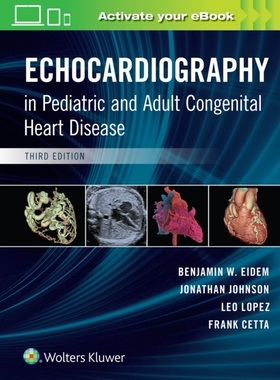 【预订】Echocardiography in Pediatric and Adult Congenital Heart Disease